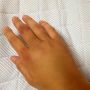 パンパンに腫れた手が、余計にパンパンに腫れ、内出血も激しくなってきた。なんなら指までパンパン。ヤバイなぁ。こんだけ腫れたら痛いはずだわ。グーパーするのでさえ皮膚がつっぱって変な感じ。