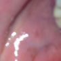 @Missymoomoo014 it was great ...needle....filling ..and oh I think the drill hit the inside if my cheek :))) 
