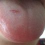 I mean properly bit it. 
#warning tongue close up
#answersonapostcard